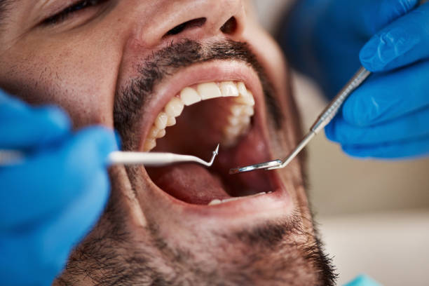 Best Emergency Wisdom Teeth Removal in Fordyce, AR