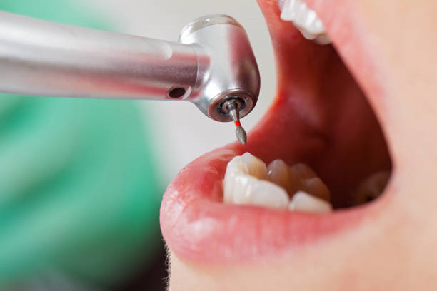 Best Emergency Dental Care for Broken or Chipped Teeth in Fordyce, AR